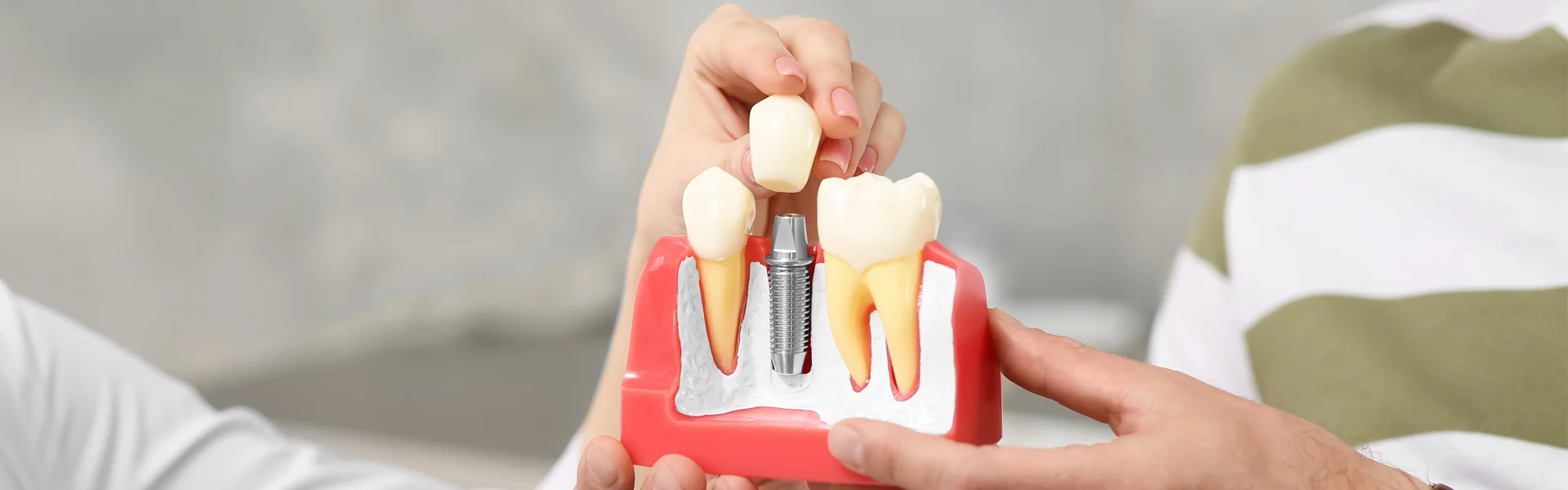 8 Dental Implant Maintenance Tips for Long-term Success